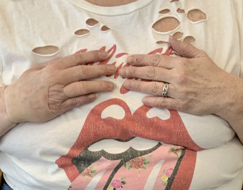 Christina silicone partial hand